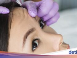 Botox vs Filler, Mana yang Paling Tokcer Kencangkan Wajah Hingga Usia Tak Lagi Muda?