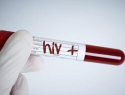Begini Ciri-ciri HIV yang Muncul Hingga Kemaluan Pria